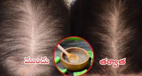 Hair Fall: జుట్టు రాలుతోందా ? వీటిని వాడితే.. అస్సలు రాలదు