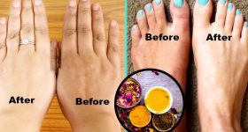 Skin Care: ముఖంతో పోలిస్తే.. మీ చేతులు, కాళ్లు నల్లగా ఉన్నాయా ?