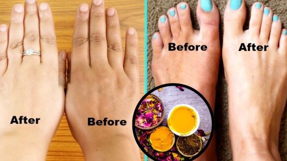 Skin Care: ముఖంతో పోలిస్తే.. మీ చేతులు, కాళ్లు నల్లగా ఉన్నాయా ?