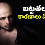 Hair Care: మీరు చేసే ఈ తప్పులు మీకు బట్టతల రావడానికి కారణంగా మారుతాయి