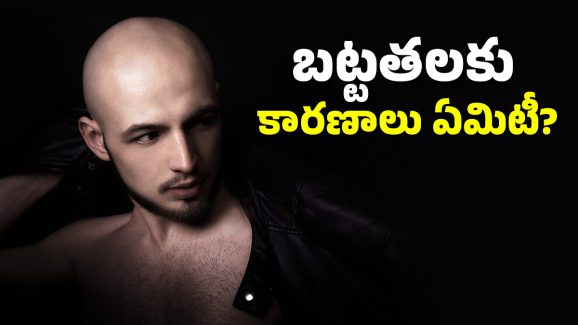 Hair Care: మీరు చేసే ఈ తప్పులు మీకు బట్టతల రావడానికి కారణంగా మారుతాయి