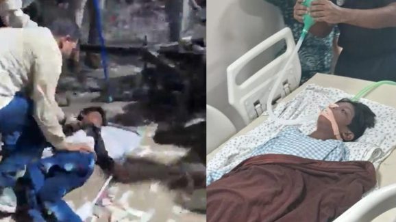 Allu Arjun Sandhya Theater Case : విషమంగా శ్రీతేజ్ ఆరోగ్య పరిస్థితి… కాసేపట్లో హాస్పిటల్‌కు కమిషనర్ సీవీ ఆనంద్