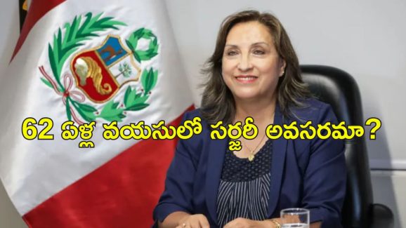 Peru President Nose: ప్లాస్టిక్ సర్జరీ చేసుకున్న ప్రెసిడెంట్.. రాజీనామా డిమాండ్ చేసిన ఎంపీలు