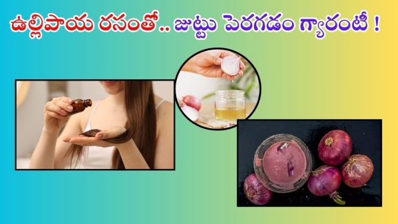 Onion Juice For Hair: ఈ ఒక్కటి వాడితే చాలు.. జుట్టు వద్దన్నా పెరుగుతుంది