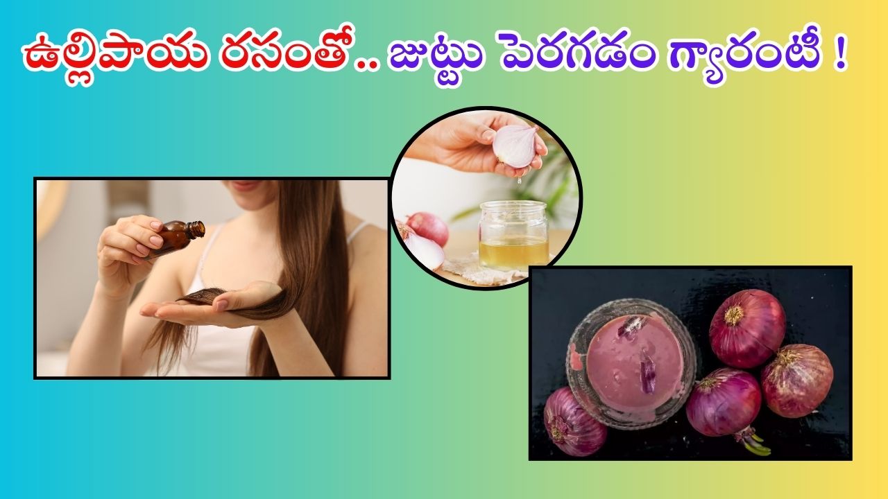 Onion Juice For Hair: ఈ ఒక్కటి వాడితే చాలు.. జుట్టు వద్దన్నా పెరుగుతుంది