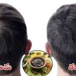 Tips For Hair Fall: బట్టతలపై కూడా జుట్టు రావాలంటే.. వీటిని పక్కా వాడాల్సిందే !