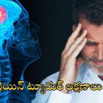 Brain Tumor: మీలో ఈ లక్షణాలు ఉంటే అస్సలు లైట్ తీసుకోవద్దు, బ్రెయిన్ ట్యూమర్ కావచ్చు