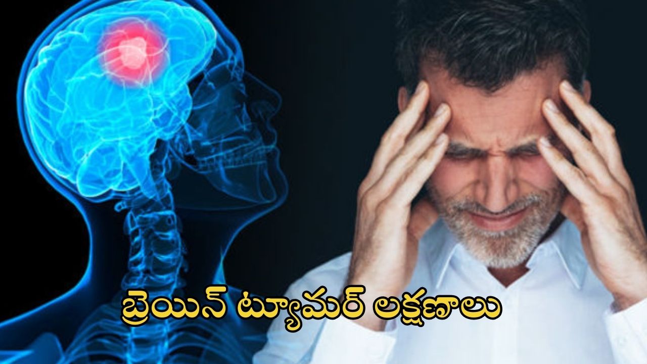 Brain Tumor: మీలో ఈ లక్షణాలు ఉంటే అస్సలు లైట్ తీసుకోవద్దు, బ్రెయిన్ ట్యూమర్ కావచ్చు