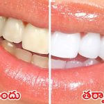 Tips For Yellow Teeth: ఇలా చేస్తే.. క్షణాల్లోనే మీ పళ్లు మెరిసిపోతాయ్