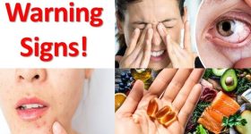 Vitamin D Deficiency: శరీరంలో విటమిన్ డి లోపిస్తే ?