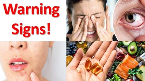 Vitamin D Deficiency: శరీరంలో విటమిన్ డి లోపిస్తే ?