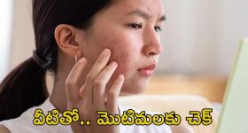 Pimple Problem: వీటిని వాడితే.. ఈజీగా మొటిమలు మాయం