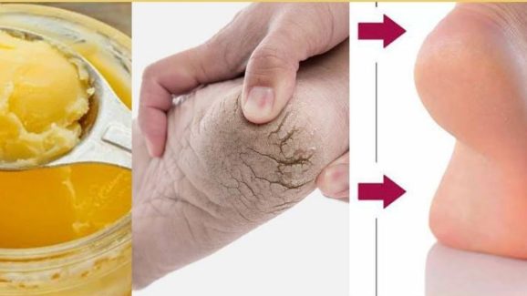 Ghee For Feet: చలికాలంలో పాదాలకు నెయ్యి అప్లై చేస్తే ?