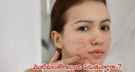 Viral Video: కారు డ్రైవింగ్ చేస్తూ ముద్దులతో రెచ్చిపోయిన జంట, చివరికి..