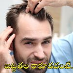 Hair Fall: బట్టతల రాకూడదంటే.. ఈ జాగ్రత్తలు పాటించండి