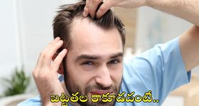 Hair Fall: బట్టతల రాకూడదంటే.. ఈ జాగ్రత్తలు పాటించండి