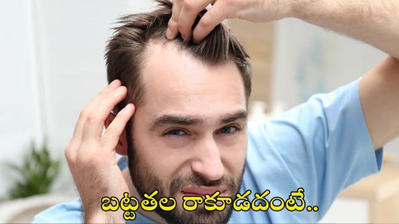 Hair Fall: బట్టతల రాకూడదంటే.. ఈ జాగ్రత్తలు పాటించండి