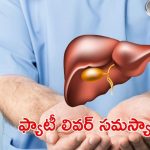 Fatty Liver: మీలో ఈ లక్షణాలు ఉన్నాయా ? ముందుగానే జాగ్రత్త పడకపోతే అంతే !