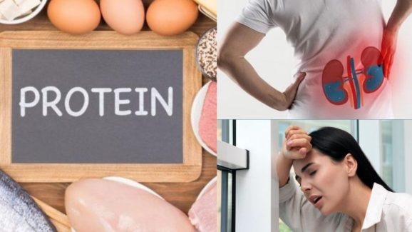 Protein Deficiency: శరీరంలో ప్రొటీన్ లోపిస్తే.. కనిపించే లక్షణాలు !