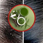 Dandruff: ఇలా చేస్తే.. వారం రోజుల్లోనే చుండ్రు మాయం