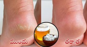 Cracked Heels: కాళ్ల పగుళ్లు వెంటనే తగ్గాలంటే.. కర్పూరంలో ఇవి కలిపి వాడండి