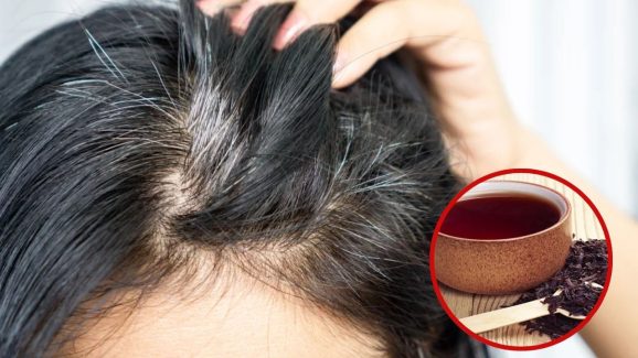 White Hair: వీటిని వాడితే చాలు.. క్షణాల్లోనే తెల్లజుట్టు నల్లగా మారిపోతుంది