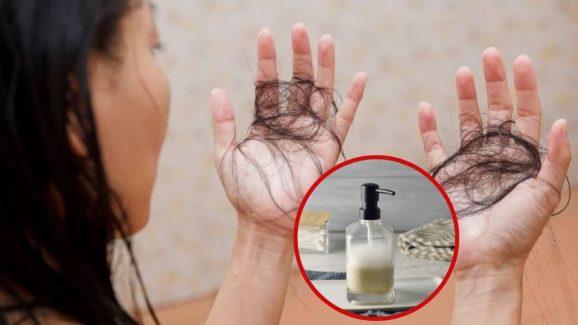 Shampoo: జుట్టుకు షాంపూ ఎక్కువగా వాడుతున్నారా ? ఎంత ప్రమాదమో తెలుసుకోండి