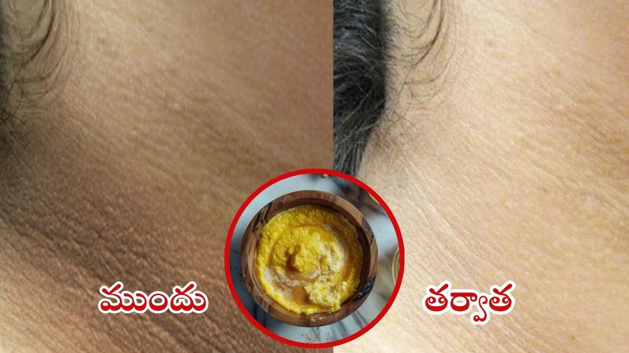 Dark Neck: మెడ చుట్టూ చర్మం నల్లగా మారిందా ? ఒక్క సారి ఈ టిప్స్ ట్రై చేయండి