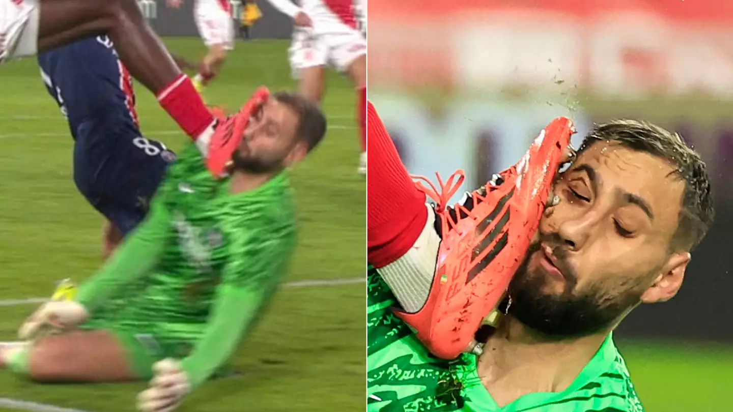 Gianluigi Donnarumma Injury: ఇదేం ఆట… ముఖంపై బూటుతో తన్ని మరీ ?