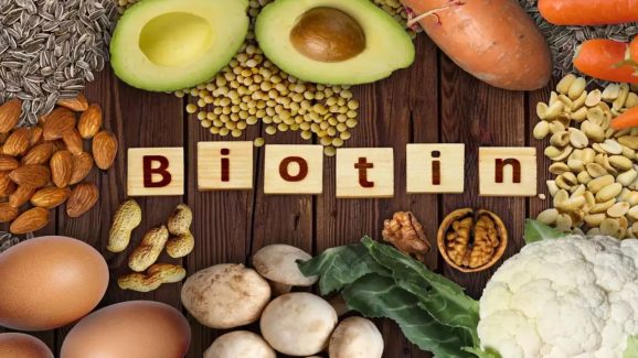 Food For Hair Growth: ఇవి తింటే.. జుట్టు రాలమన్నా రాలదు