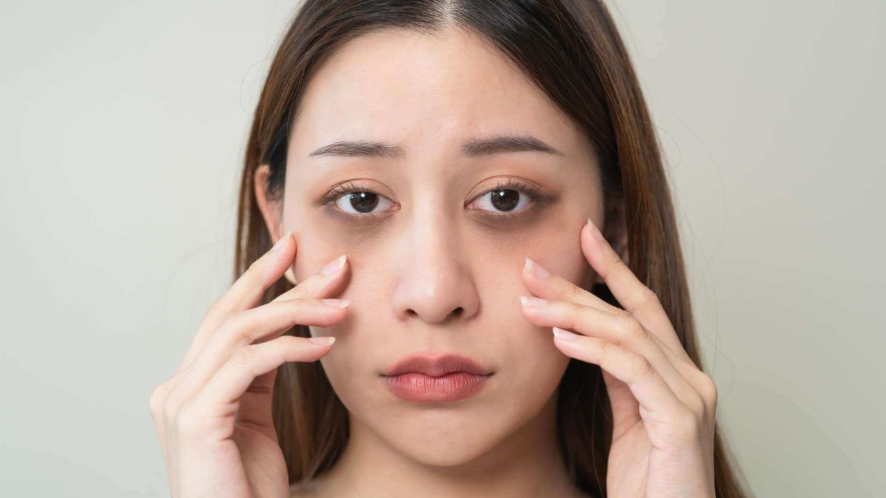 Dark Circles: డార్క్ సర్కిల్స్ తగ్గించే.. బెస్ట్ టిప్స్