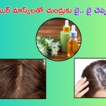Dandruff Tips: చలికాలంలో చుండ్రు సమస్యతో ఇబ్బంది పడుతున్నారా..? ఇలా చేస్తే చాలు