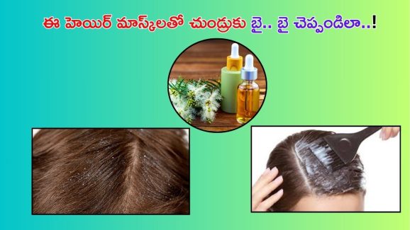 Dandruff Tips: చలికాలంలో చుండ్రు సమస్యతో ఇబ్బంది పడుతున్నారా..? ఇలా చేస్తే చాలు