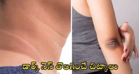 Dark Elbows: మెడ, మోచేతులపై డార్క్ నెస్ క్షణాల్లో.. పోగొట్టే చిట్కాలు