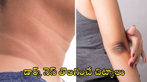 Dark Elbows: మెడ, మోచేతులపై డార్క్ నెస్ క్షణాల్లో.. పోగొట్టే చిట్కాలు