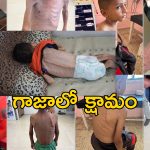 Gaza Famine : గాజాలో ఆకలికేకలు.. క్షామంతో మృత్యుఘోష.. కళేబరాల్లా పిల్లల శరీరాలు