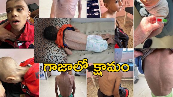 Gaza Famine : గాజాలో ఆకలికేకలు.. క్షామంతో మృత్యుఘోష.. కళేబరాల్లా పిల్లల శరీరాలు