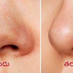 Blackheads: ఇంట్లోనే బ్లాక్ హెడ్స్‌కు చెక్ పెట్టండిలా !