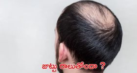 Tips For Hair: విపరీతంగా జుట్టు రాలుతోందా ? ఇలా చేస్తే.. ప్రాబ్లమ్ సాల్వ్