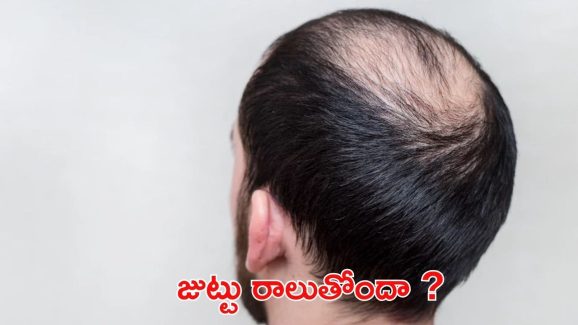 Tips For Hair: విపరీతంగా జుట్టు రాలుతోందా ? ఇలా చేస్తే.. ప్రాబ్లమ్ సాల్వ్