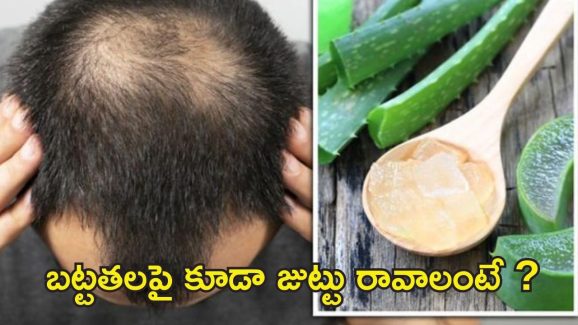 Tips For Hair Fall Control: బట్టతలపై కూడా జుట్టు రావాలంటే.. ఇలా చేయండి !