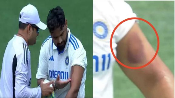 Rishab Pant: టీమిండియాకు బిగ్‌ షాక్‌.. పంత్‌ కు తీవ్ర గాయం !