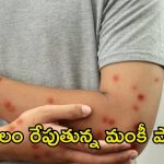 Monkeypox: కలకలం రేపుతున్న మంకీ పాక్స్.. ఈ ఏడాది తొలి కేసు నమోదు, ఎక్కడంటే ?