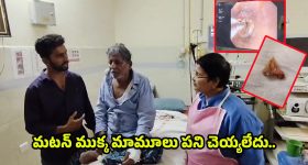Bone Stuck in Man Throat: గొంతులో ఇరుక్కున్న మటన్ ముక్క.. ఎలా తీశారంటే..