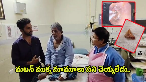 Bone Stuck in Man Throat: గొంతులో ఇరుక్కున్న మటన్ ముక్క.. ఎలా తీశారంటే..