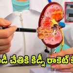 Kidney Racket Case: సీఐడీ చేతికి కిడ్నీ రాకెట్‌ కేసు.. ఆసుపత్రి ఛైర్మన్‌ సహా ఇద్దరు అరెస్ట్