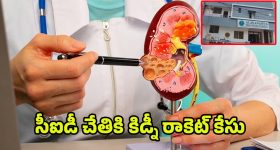 Kidney Racket Case: సీఐడీ చేతికి కిడ్నీ రాకెట్‌ కేసు.. ఆసుపత్రి ఛైర్మన్‌ సహా ఇద్దరు అరెస్ట్