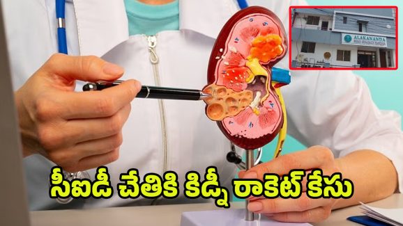 Kidney Racket Case: సీఐడీ చేతికి కిడ్నీ రాకెట్‌ కేసు.. ఆసుపత్రి ఛైర్మన్‌ సహా ఇద్దరు అరెస్ట్