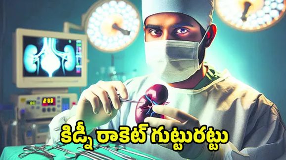 Kidney Racket Case: కిడ్నీ రాకెట్ గుట్టురట్టు.. ఆరునెలల్లోనే వంద కిడ్నీ మార్పిడి ఆపరేషన్లు