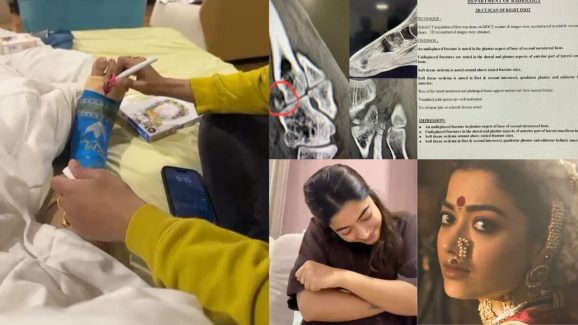 Rashmika mandanna: మూడు చోట్ల ఫ్రాక్చర్.. గాయం పై స్పందించిన రష్మిక..!